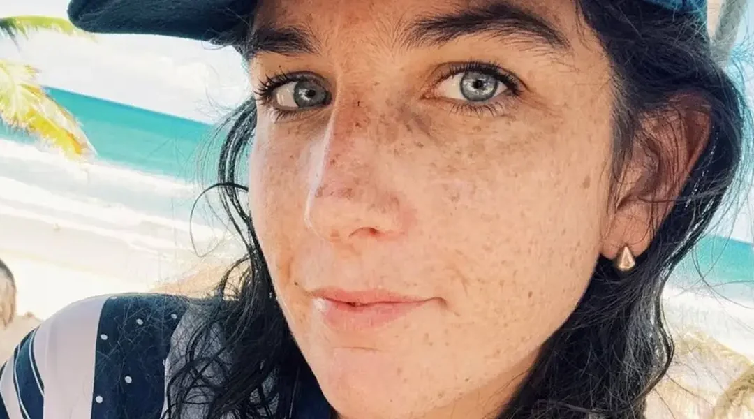Juana Repetto mostró cómo le quedó la cicatriz de la cesárea de su tercer hijo