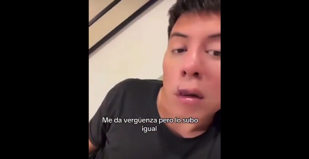 Mariano De la Canal desfigurado por un perro