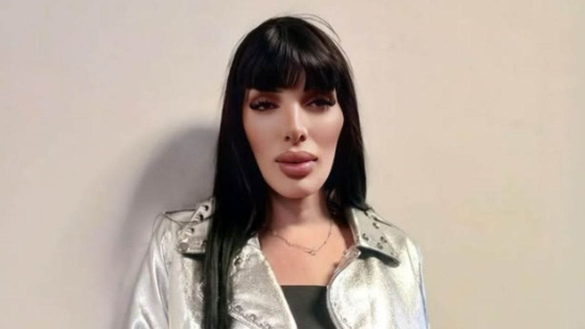La Cuerpo reveló que tiene dos tumores en los ojos