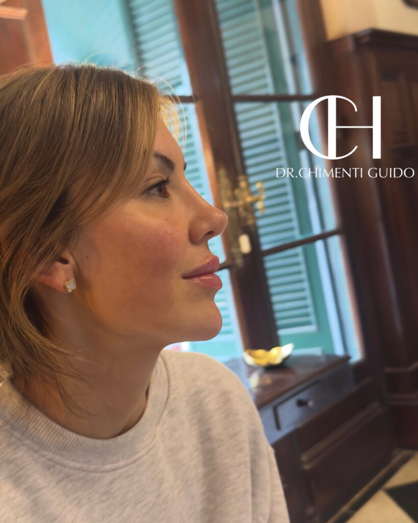 Así quedó Muriel López Benítez tras el retoque