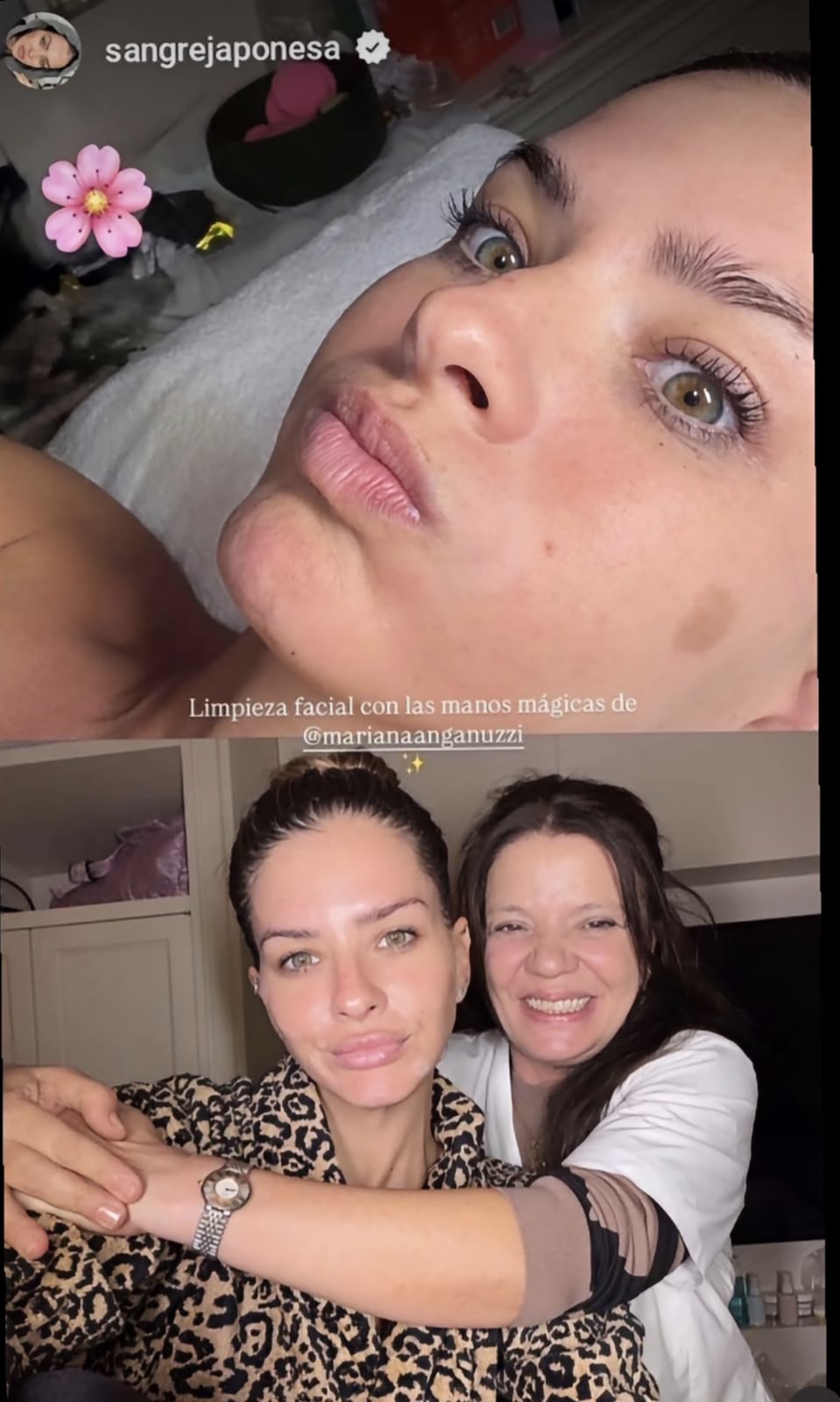 La China Suárez se atendió con su cosmetóloga de confianza 