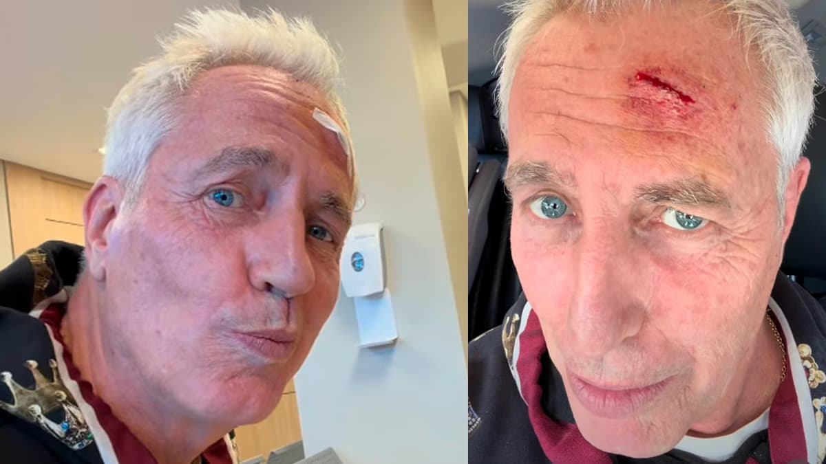 Se accidentó Marley, terminó en el quirófano y mostró cómo le quedó la cara